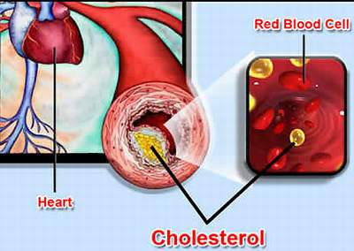Heart Cholesterol